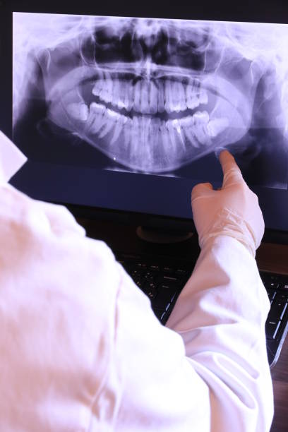 Best Broken or Cracked Tooth Emergency Dentist in Eldersburg, MD